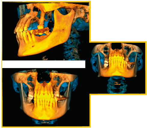 IMAGEN 3D