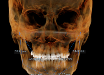 CR-SIMETRIA MANDIBULAR