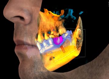 Proface3d01