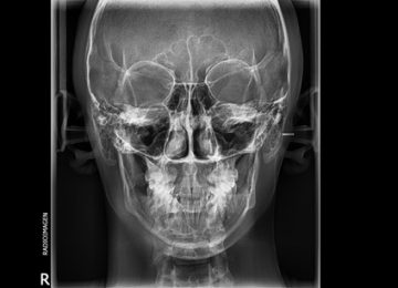 antero-posterior01