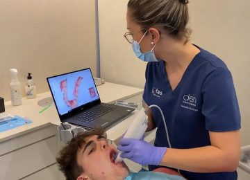escanintraoral02