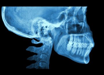 radiografia-lateral-craneo-temp