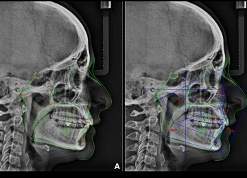radiografia-lateral-craneo-temp002